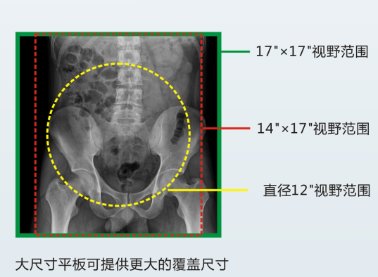 動態DR成像視野