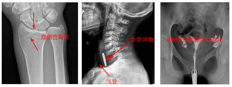 動態DR機準確點片